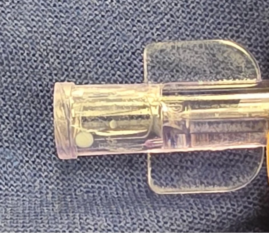 Propofol leakage close up Propofol leakage close up
