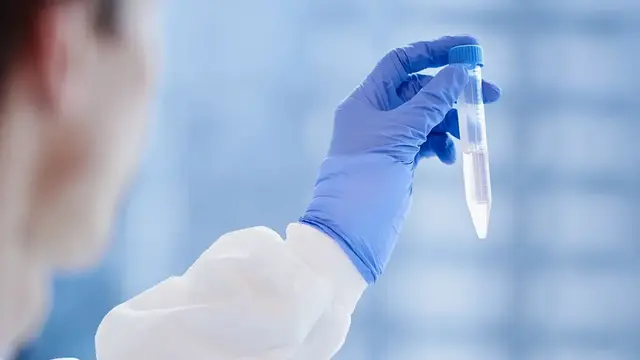 A scientist examines a test sample, representing the rigorous analysis and research behind perioperative medicine trials aimed at improving patient outcomes.